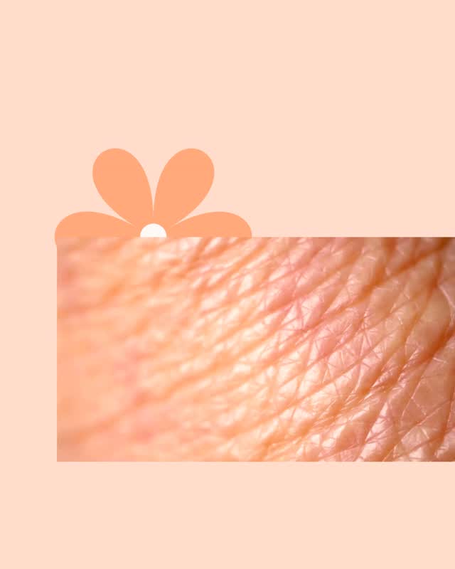 Wrinkles aren’t “just age”, they’re basically your skin’s collagen + elastin getting a little tired plus life leaving its cute little receipts.
So what actually causes wrinkles? The big ones:
- Sun (UV) damage: the #1 wrinkle-maker. UV breaks down collagen + elastin and creates that “crepey” texture over time.
- Collagen loss with age: from our mid-late 20s we naturally produce less collagen each year, so skin doesn’t bounce back as fast.
- Repeated facial movement: smiling, frowning, squinting = expression lines (totally normal, totally human).
- Dehydration + impaired barrier: when your skin barrier is weak, fine lines look deeper because skin looks thinner and more “crumpled.”
- Lifestyle + inflammation: smoking/vaping, poor sleep, stress, high sugar/low nutrient diets can all accelerate glycation and dullness.
- Menopause/perimenopause shifts: hormones change how your skin holds water and builds collagen (hello dryness + fine lines).
When do wrinkles start?
Most people notice the first fine lines in their late 20s to early 30s, especially around the eyes (crow’s feet) and forehead, usually from UV + expression + dehydration. Deeper lines tend to show up more through the 30s-40s, and texture/crepiness becomes more obvious when skin is drier or hormonally shifting.
My pro-ageing approach is: protect, build, hydrate, stimulate.👇
1. SPF 50+ every single day (yes, even driving to Woolies)
2. Vitamin C (AM) to support collagen + brighten
3. Bakuchiol (PM) a gentle, plant-based collagen-supporting alternative to retinol for smoother texture + fine lines
4. LA Cleanser (Lactic Acid) to softly exfoliate, brighten dullness and help skin look smoother (without harsh scrubbing)
5. Barrier love: like Hydra3 Lift Cream, ceramides, peptides, fatty acids, squalane - plumps lines by improving hydration + resilience
6. Consistent hydration: humectants + a good moisturiser to reduce that “crinkled” look
#proageing #skinhealth #wrinkles #spf50 #bakuchiol #lacticacid #peachfaceskincare #skincare #naturalskincare #australianskincare #crueltyfree #glowingskin #youngskin #proageing #Peachyskin #holisticbeauty #Cleanbeauty #glow #hydration