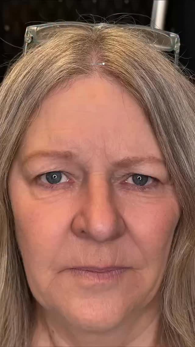 Here’s a real brow transformation ✨
First — client’s makeup.
One brow was much higher than the other. The asymmetry was easy to see — and it’s not because of bad makeup. Her natural brow shape is just like that, so every morning she had to try hard to make them look more even.
Then — no makeup.
Her brows were almost invisible. Very light, very thin and the face instantly looked less expressive. I know many women will recognise this situation 😉
And finally — Hyperrealism Nano Brows ✨
Soft. Natural. Clean. We balanced the shape, kept everything looking real, and added gentle, hair-like strokes. Now no one would ever guess it’s permanent makeup — it simply looks like naturally perfect brows 🫶
If you’d like the same kind of transformation, follow the link in bio for booking ✨
____________________________________________________
Permanent Makeup Services, Tattoo Removal & Carbon Laser Facial
⬆️Book apt with the link in bio
✨Free Consultation available
📍Oshawa, Ontario
✉️ browsbyieva@gmail.com
📱 +1 416-804-6749
Website: permanentbeautybyieva.com
#nanobrowsoshawa #oshawapermanentmakeup #oshawabrows #whitbypermanentmakeup #whitbybrows