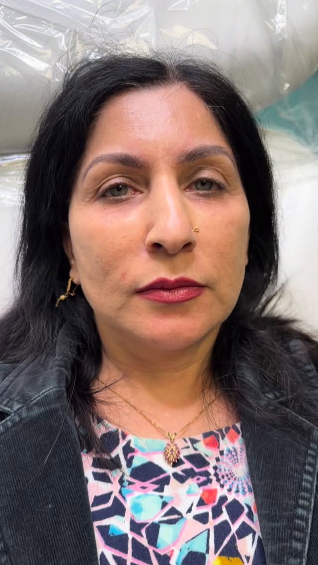 Annual nano brow touch up time for this beauty. She asked for filler thicker brows this go around, so we did just that. I loved how soft these healed initially ♥️
Come see me in San Mateo and take advantage of affordable bros in the Bay Area.
Nano brows
San Mateo brows