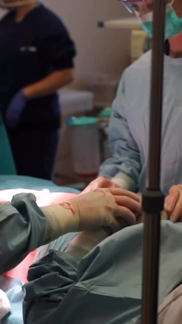 🎥: @evarosebirth
A mother assisted cesarean is empowering, beautiful, and deeply connected.
It is a way of welcoming your baby with intention, participation, and presence, even in a surgical setting. While this kind of belly birth is not for everyone, it is an option and one that deserves to be more widely available.
With thoughtful preparation, clear information, and supportive care that helps keep the mind and body calm, being involved in your own cesarean is absolutely possible.
Birth does not lose its power just because it looks different.
Choice, autonomy, and connection belong in every birth space.
💚
#GentleCesarean
#CesareanBirth
#InformedBirth
#EmpoweredBirth
#BirthEducation