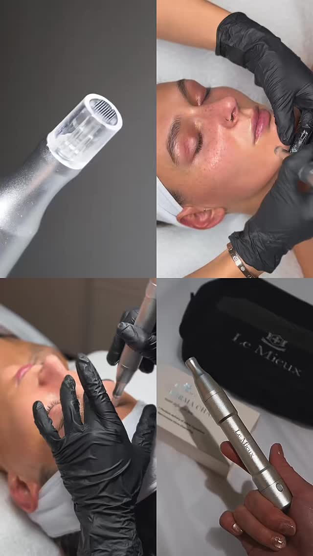 Cleanse. Infuse. Glow. 🤍
2026 is your year to shine. Say goodbye to dull skin and hello to radiant, hydrated, needle-free magic with Derma Channel Nano Infusion Facial.
Products used:
• Pure Erb - Cleansing Oil
• Le Mieux - Peptide Foam Cleanser
• Le Mieux - Derma Channel Nano Infusion
• Le Mieux - Hyaluronic Serum
• Le Mieux - EGF-DNA Serum
Website 🔗www.ricozybeauty.com
Contact 📩 info@ricozybeauty.com
Location📍300 E Colorado Blvd, Unit 241, Studio 409, Pasadena CA 91101
#lemieux #skincare #dermachannel #facial #esthetician