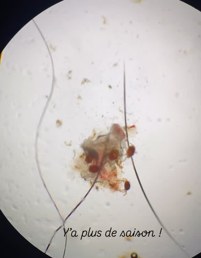 Larves d’acariens généralement observées à la saison des vendanges. Les aoûtats se nichent au niveau des griffes, de la zone de Henry au niveau auriculaire et peuvent entraîner un prurit intense ! #vetdermatologiemarseille #veterinaire #cat #dermatologie #aoutats #trombiculaautumnalis