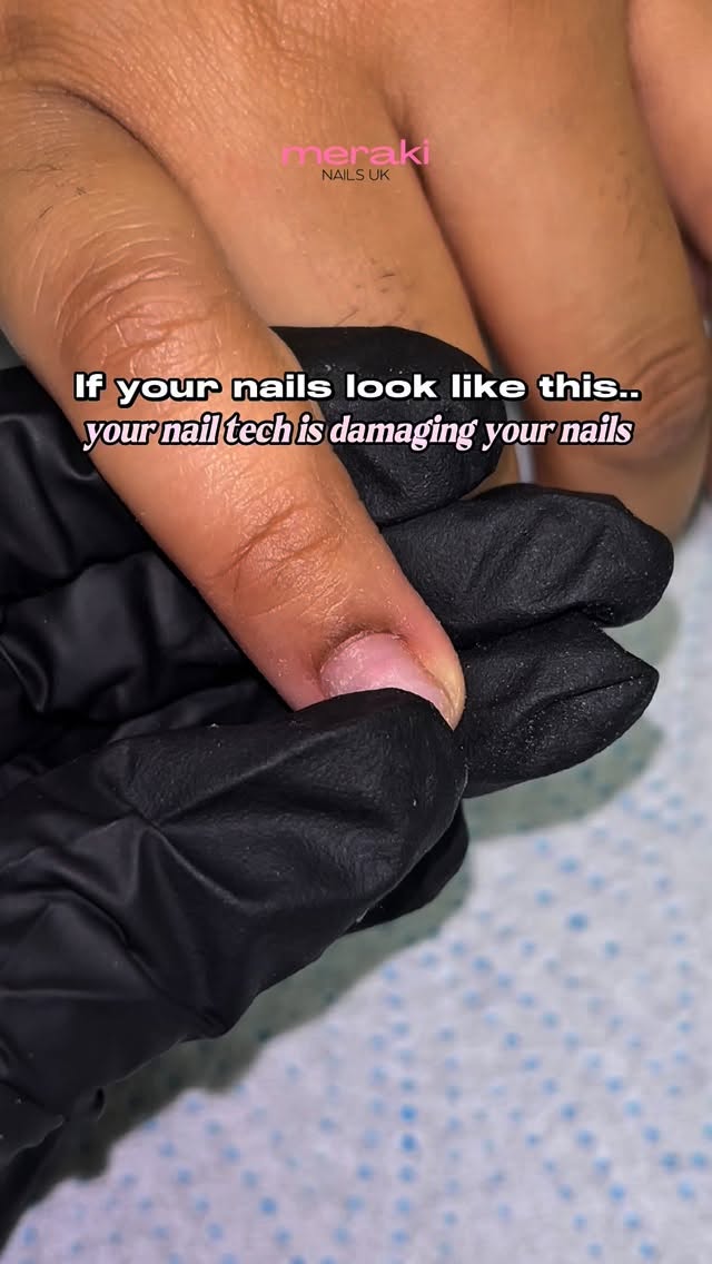 If your nails look like this… your nail tech is damaging your nails
❗️Wrong techniques cause damage, whether that’s acrylic, biab or any other gel service
This is an example of over-filing, often known as “rings of fire”
Rings of fire are dents on the natural nail that appear slightly red and curved & they are not normal
Over time, this can cause sensitivity and damage
The good news:
✔️ It will grow out
✔️ The natural nail can recover
Common causes 👇🏽
• Using the wrong drill bit on the natural nail
• Using the correct drill bit but over-filing with too much pressure
Remember:
The product isn’t the problem
The technique is 💅🏽