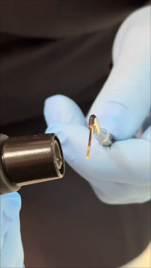 Você já puxou o cone bem na hora de cortar o excesso?
Acontece mais do que parece — e, muitas vezes, o problema não é “falta de habilidade”… é controle de temperatura e tempo de contato.
No vídeo, repare: a ponta vai até o vermelho-rubro.
Isso é um sinal claro de temperatura excessiva para o corte rotineiro do cone.
O que pode dar errado quando você superaquece o calcador?
• O cone pode aderir ao instrumento e “subir” junto no corte.
• O calor pode amolecer a gutta-percha além do desejado, gerando arraste e perda do selamento no terço cervical.
• Aumenta o risco de deslocamento do cone principal, principalmente se você cortar “tracionando” em vez de “seccionando”.
Como reduzir esse risco (na prática):
1. Aqueça até o ponto necessário até incandescer.
2. Encoste rápido e com pressão mínima — corte é contato breve, não permanência.
3. Evite “puxar”: faça um movimento de seccionamento e retire o instrumento sem tração.
. #endodontia 
#odontologia
#endodontista 
#tratamentodecanal 
#obturação