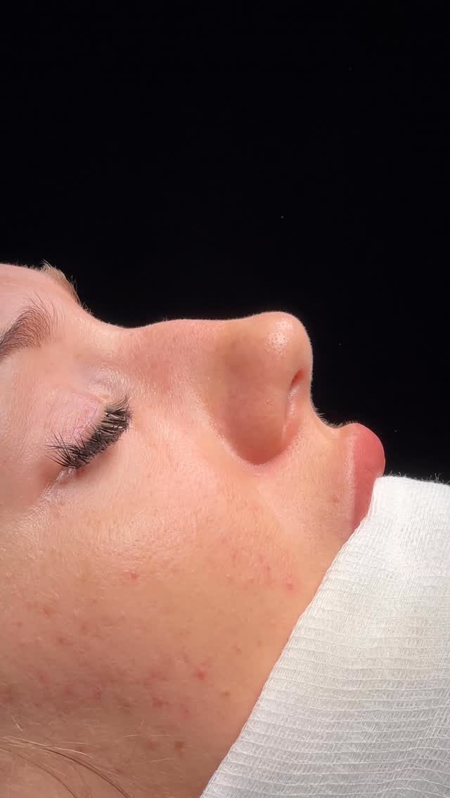 When the surgery is over. ⭐️
From Belarus.