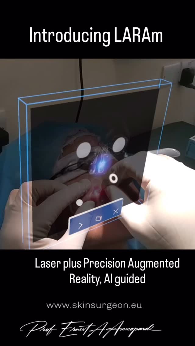 ✨ LARAm™ - here applied to scars
Presented today in Milan to an international expert audience.
An advanced laser technique enhanced by augmented visual precision, designed to refine scars and restore skin with elegance and natural harmony.
Discreet. Personalised. Beautifully precise.
Because the most sophisticated results are nuanced, not announced.
Conferences are all about accountability not visibility. You saw it here first. World premiere.
CT scan slice, superimposed onto the patient’s own head, whilst the Augmented Reality kit guides my hands and my eyes to the target to deal with a difficult lesion under the skin. Science fiction ? No. It’s reality now.
📧info@skinsurgeon.eu
Professor Ernest Azzopardi
Remedies Campus Malta #+356 79976680
The London Welbeck Hospital &HarleyStreet
+44 7970696321