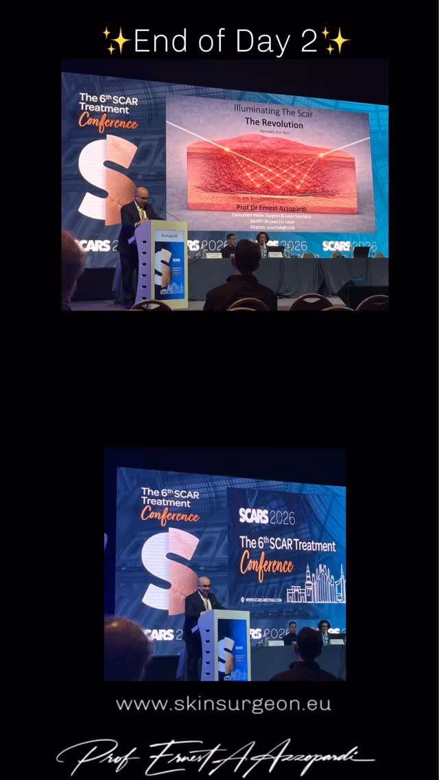 ✨ End of Day 2 – SCAR Treatment Conference ✨
Honoured to engage in insightful discussions on advanced laser strategies in scar management.
Grateful to the organisers and colleagues for an excellent scientific exchange.
Now about that glass of wine……😎✨
🔗 www.skinsurgeon.eu
— Prof Ernest A. Azzopardi