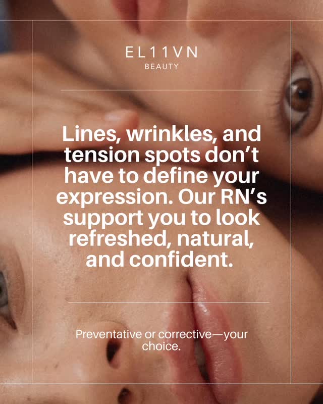 ✨✨Smooth, Natural, Confident ✨✨
Lines and wrinkles don’t have to define your expression. Our neuromodulator treatments help you look refreshed and natural—without fillers or downtime.
💉 Quick, safe, and effective
🌿 Preventative or corrective—your choice
📅 Book your consultation today and experience why this treatment is our specialty-🔗link in PROFILE
#NeuromodulatorExperts #el11vnbeauty #SmoothAndConfident #NaturalResults #AntiAging SelfCare ExpressYourBest