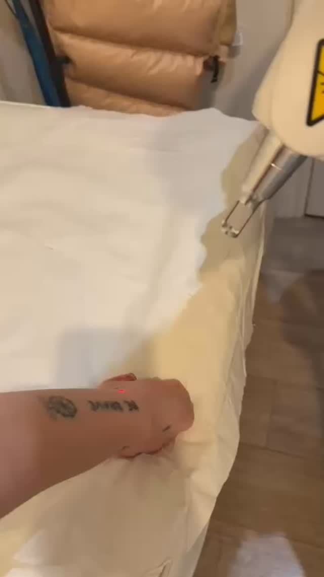 ✨ TATTOO REMOVAL AVAILABLE ✨
✔ Safe & non-invasive
✔ Modern technology
✔ Visible fading over sessions
🎉 Limited-time offer – message us to book now!