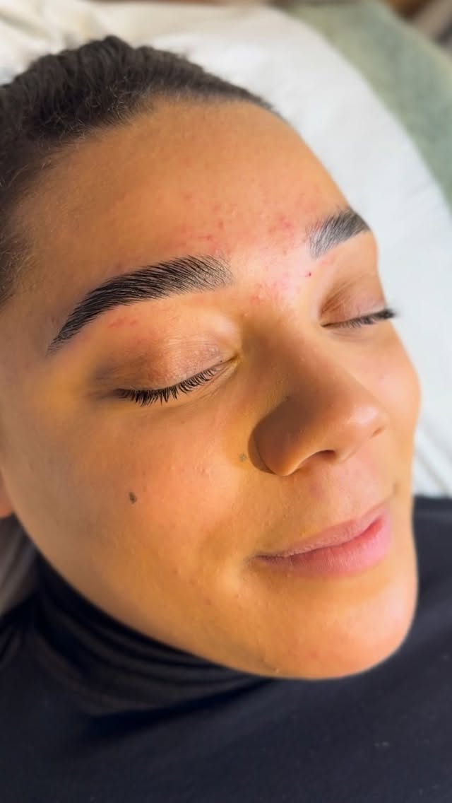 What actually is brow lamination?
Think of it as a lash lift⌠but for your brows.
Brow lamination is a treatment that softens and resets the brow hairs, allowing us to re-shape and set them in a more lifted, fuller-looking position. We brush the hairs into place, fix them with a setting solution, and the result is brows that look thicker, neater, and way more defined - without a single brow pencil in sight.
Perfect if you:
Have unruly or downward-growing brow hairs
Want a fluffier, fuller look
Are tired of styling your brows every morning !!
Results last around 6 weeks and include a tint and tidy for the full effect.
DM to book your appointment or ask if itâs right for you.
#browlamination #cheltenhambrows #nineteenbeauty #browlift fluffybrows browgoals