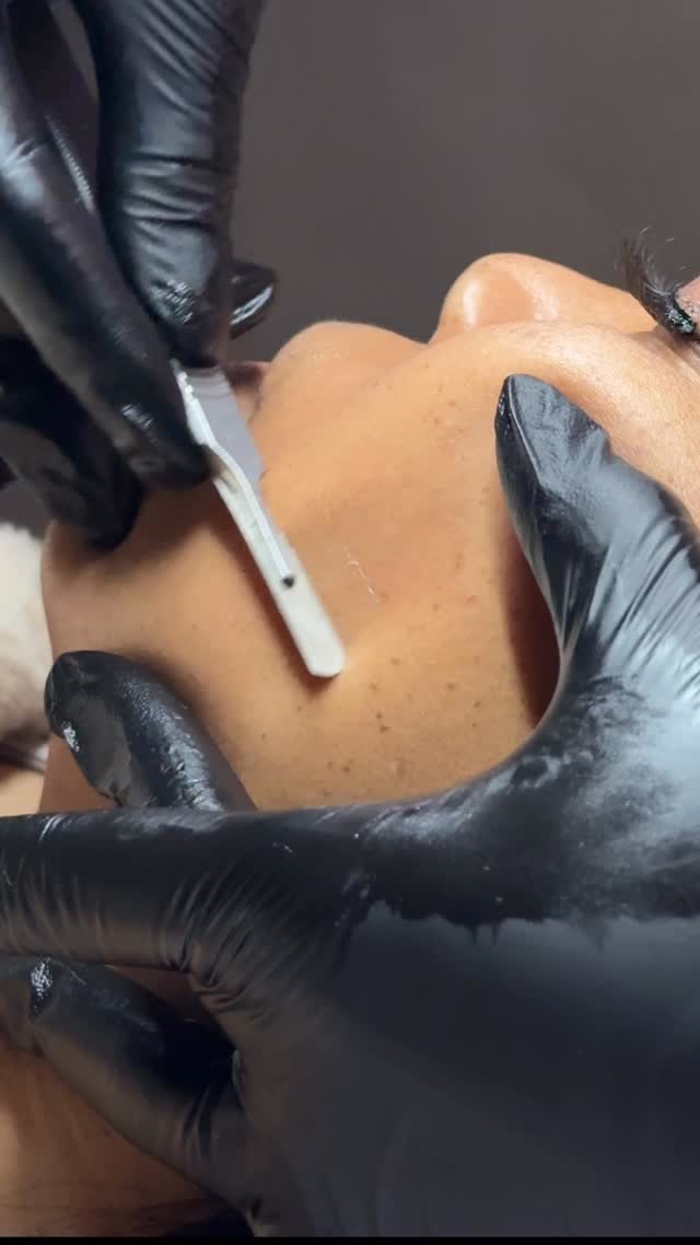 𝘿𝙚𝙧𝙢𝙖𝙥𝙡𝙖𝙣𝙞𝙣𝙜 gently exfoliates the skin, removes dead skin + vellus hair, leaves you smooth, bright, & glowing.
So smooth even 🍑 are jealous✨
𝘉𝘰𝘰𝘬 𝘰𝘶𝘳 𝘗𝘦𝘢𝘤𝘩 𝘍𝘶𝘻𝘻 𝘎𝘰 — 𝘭𝘪𝘯𝘬 𝘪𝘯 𝘣𝘪𝘰
…
#skingoals #smoothskin #dermaplane #facial #snellvilleesthetician