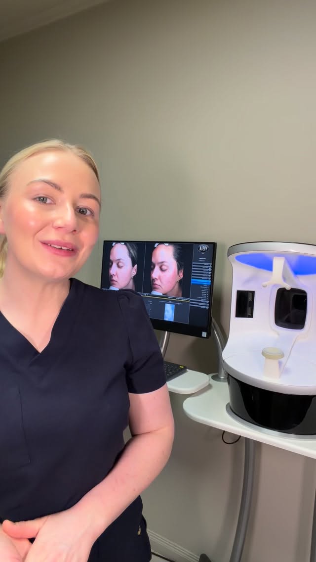 VISIA SCAN ❤️
👉🏼 hudanalyse er IKKE det samme uten. Dette er et uvurdelig verktøy for oss, og helt ærlig skjønner jeg ikke hva vi dreiv med for 6 år siden uten denne maskinen 🥲 Den brukes daglig og flittig - og vi opplever at våre kunder får bedre forståelse for egen hud og enklere klarer å prioritere eller beskrive hva de ønsker å jobbe med. Dette er nøkkelen til en god hudsamtale - og en vesentlig del av alle våre konsultasjoner 🗣️
Visste du at…
👉🏼 vi er den første, og eneste, tilbyderen av Visia scan i Grimstad? Vi har lang og bred erfaring i bruk av maskinen, og bruker den altså hver eneste dag i klinikken.
👉🏼 ALLE våre medlemmer får GRATIS årlig scan inkludert i sine medlemskap? Bare book i forkant av din neste time!
👉🏼 Visia scan er selvfølgelig inkludert i prisen når du handler hudprogram eller gjør behandling hos oss 🤓
👉🏼 Om du er nysgjerrig, og bare ønsker oversikt, kan du bestille time til konsultasjon uforpliktende uten å binde deg. Det koster 1019,- men er da gratis om du velger å gjøre behandling eller handle produkter samme dag 🥳 Vi setter alltid av god tid til deg!
Har du tatt Visia scan hos oss før? Hva er din erfaring? 😍 Del gjerne 👇🏼