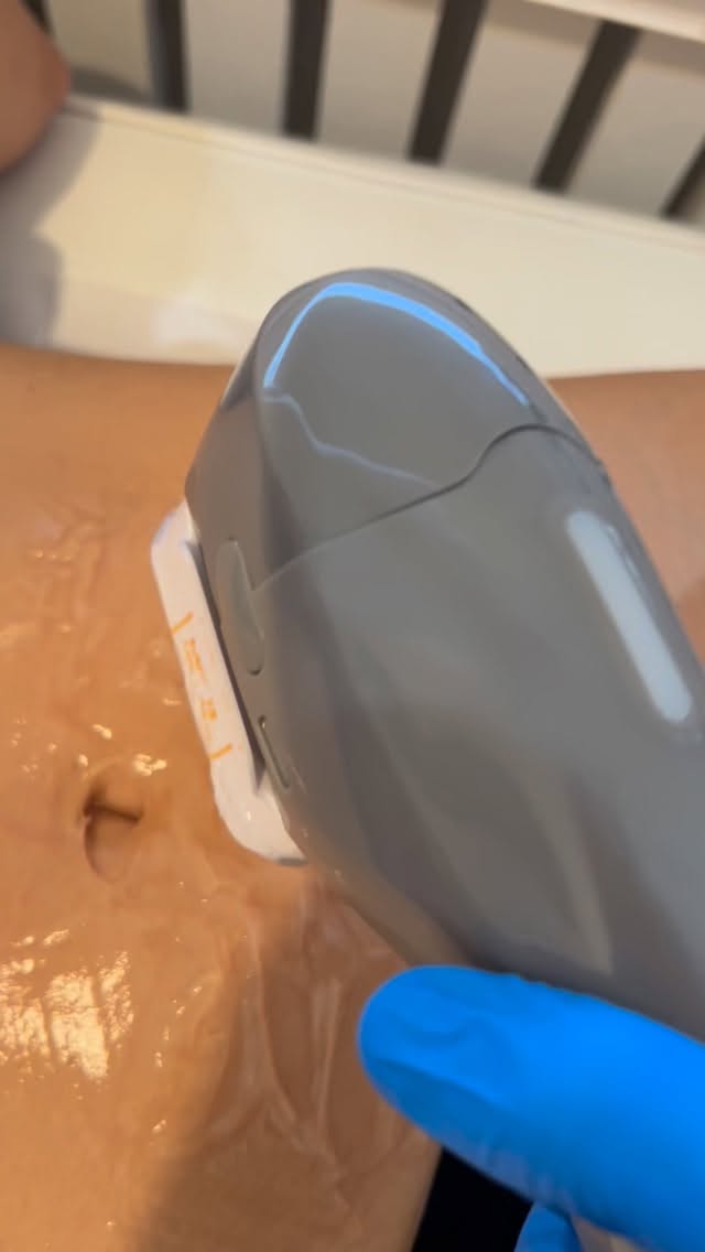 Ready to tighten and contour without surgery?
Our Body HIFU treatment is designed to help improve skin firmness and definition in stubborn areas.
🔥 Limited slots available
📍 Fulham Road
📲 Book now / DM us