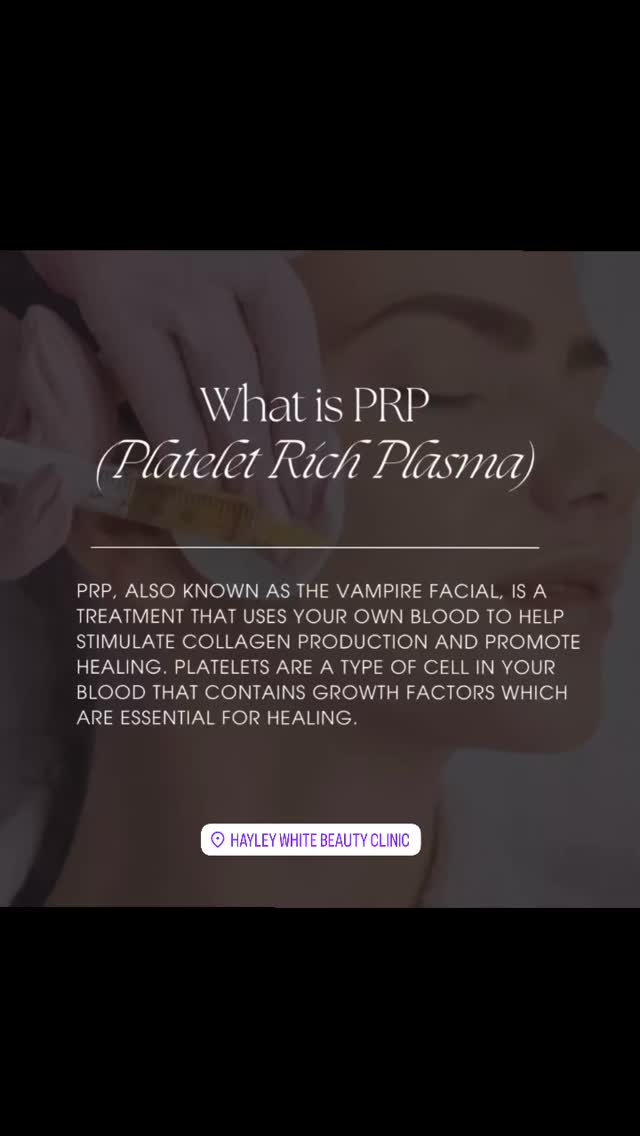 Looking for natural skin rejuvenation? The PRP Facial uses your own blood’s growth factors to stimulate collagen, improve texture, and restore glow, no fillers, no chemicals.
What is PRP?
PRP (Platelet-Rich Plasma) is derived from a small blood draw, then spun to isolate powerful platelets that help repair and renew skin.
Benefits 🩸✨
• Boosts collagen & elastin
• Improves fine lines & wrinkles
• Helps with acne scars & uneven texture
• Brightens dull, tired skin
• Enhances overall skin tone & glow
How it works 🔬
1️⃣ Small blood draw
2️⃣ Platelets separated & concentrated
3️⃣ PRP applied with microneedling
4️⃣ Skin begins natural regeneration
Downtime ⏳
Minimal! Mild redness for 24–48 hours.
Best for:
✔️ Aging skin
✔️ Acne scarring
✔️ Dull or uneven complexion
✔️ Clients wanting natural results
📅 Results improve over several weeks as collagen rebuilds.
📩 DM us to book your PRP Facial or for a consultation!
#PRPFacial #VampireFacial #SkinRejuvenation #CollagenBoost #NaturalBeauty