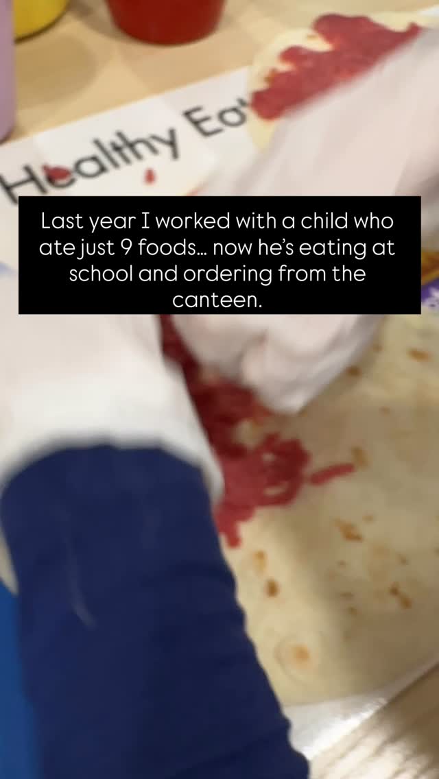 I’m a nutritionist & feeding therapist who specialises in extreme picky eating and ARFID — and this is the kind of progress that never comes from pressure.
This child didn’t jump from safe foods to full plates overnight.
We worked step-by-step to:
✅ Stabilise intake
✅ Build trust with food
✅ Reduce anxiety
✅ Increase exposure safely
✅ Expand foods at his pace
Now?
👉He’s trying new foods
👉Eating confidently at school
👉And participating in canteen days
If your child feels “stuck” with eating, please know this:
Change is possible — with the right support and plan.
Comment HELP if you want help supporting your child the same way — gently, realistically, and effectively.
#feedingtherapy
#extremepickyeating
#arfidsupport
#pickyeatinghelp
#paediatricnutrition