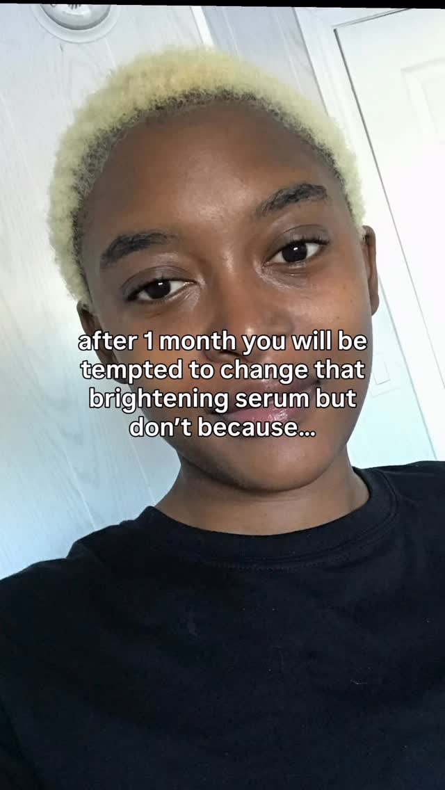 @topicals Faded Brightening & Clearing serum is one of the few hyperpigmentation treatments that has given me the most consistent results with no irritation in the last 2years.
However I almost gave it up before reaping the benefits because 3 weeks into using it daily I was already frustrated by a seemingly lack of results .
To be honest what kept me going was the fact that I spent quite a bit of money to get it shipped from the US and hate wasting money. So, I kept using it .
It wasn’t until the 3rd month that I realised how better my skin had gotten after coming across an older picture of myself and boy was I grateful!!
The Faded serum is def one of those slow burners that will have you trust the process just like having faith in God 😁
Now let’s talk formula:
1- the cocktail of brightening actives in this serum tackle pigmentation in multiple pathways :
Azelaic acid - Tranexamic acid- Kojic acid - Melatonin- Arbutin - Licorice root - Turmeric extract - Glutathione - Niacinamide
2. It’s also contains hydrating and soothing ingredients that make it gentle enough for the skin to tolerate
Glycerin - Squalane - Shea Butter - Jojoba Oil - Cica
I hope this encourages to give your treatments more time before switching to something else cuz you could be 1 application away from achieving your results.
#topicals #fadedserum #hyperpigmentationtreatment #darkspotserum