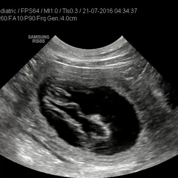 Indy begon al met nestjes maken op de bank, maar nu is het ook officieel bevestigd! Indy is drachtig! 🥰🎉
Lees er alles over in de nieuwe blog, link in bio. 🎞
#hetgooisforest #kooikerhondje #kooiker #kooikerofinstagram