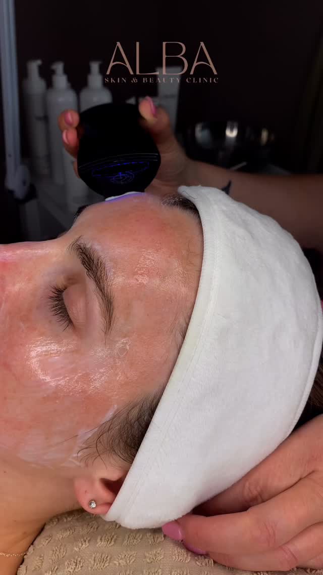 After a facial, simple adjustments help your skin recover and keep that glow for longer.
Here are a few things to focus on:
1. Hydrate well - to support the skin barrier and help active ingredients work their best.
2. Use SPF daily - to protect fresh skin from UV and oxidative stress.
3. Keep it gentle - avoid harsh actives, scrubs, and heavy makeup for the next day or two.
4. Avoid heat exposure - (saunas, hot yoga, steam rooms) while the skin settles.
Small steps, long-lasting results.
📍 Cirencester
📞 01285 238070
#ALBASkinClinic #FacialAftercare #SkinTips #HealthySkinHabits #DoctorLedClinic