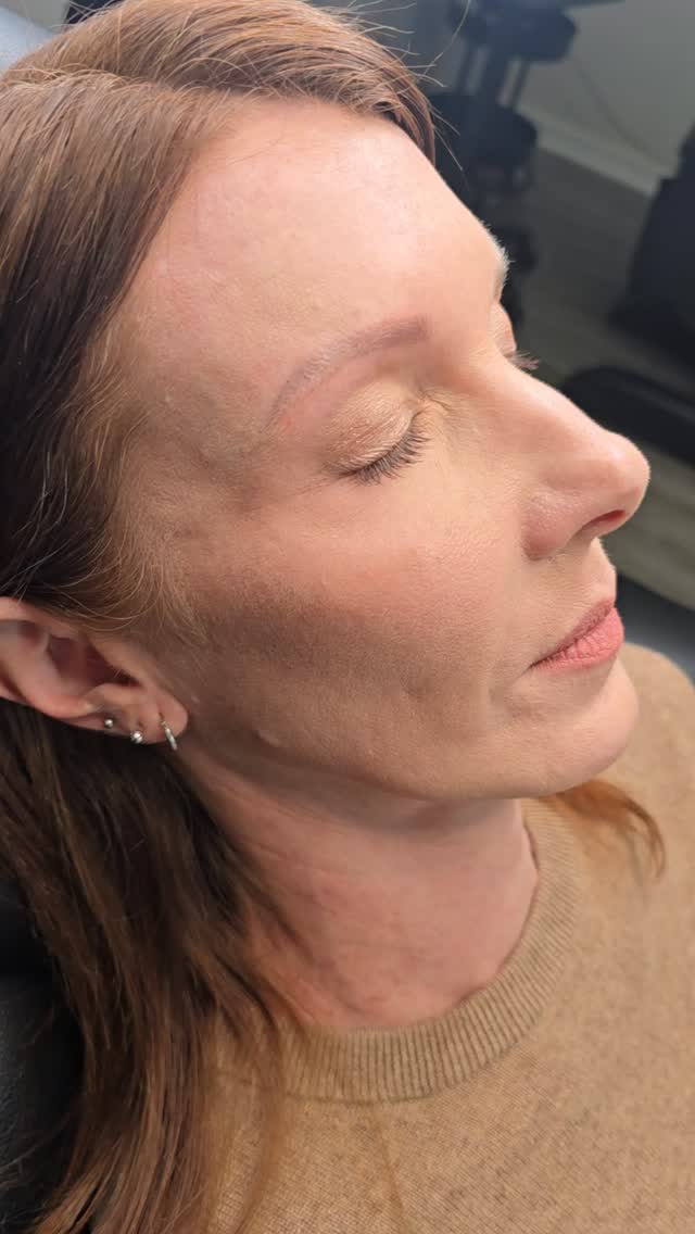 Just gave these brows a flawless touch-up! Powdery pixels are my weakness ♥️
Ready to book your appointment? You can easily book online at www.charlestonpermanentmakeup.com or by sending a text to 843-499-4357!
#Eyebrows #powderbrows #permanentmakeup #SouthCarolina #Charleston