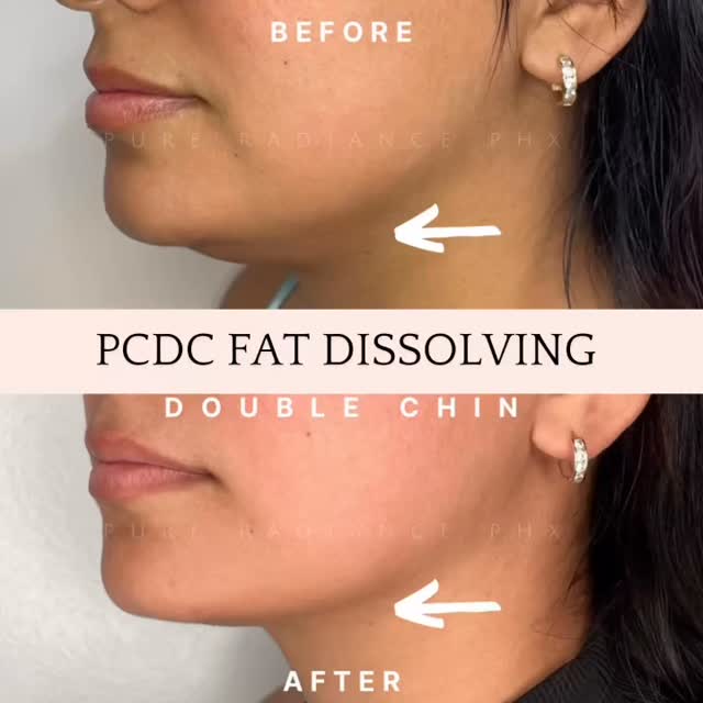 Prioritizing Wellness at EL11vn Beauty
Are you chasing quick results that never seem to last? Wondering why “fast fixes” often lead to frustrating setbacks?
Curious why some fat cells remain even after weight loss and strength training?
At EL11vn Beauty, we focus on realistic, science-based results—not hype.
Let’s talk about what can truly be achieved in 12 weeks when wellness is approached the right way.
Let’s connect:
📲 Text to book your FREE Consultation
👩🏼⚕️ Nurse Mel
📍 Burlington, ON