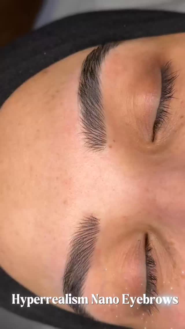Previous work removed.
Brows re-imagined.
After laser removal of old microblading, we created Hyperrealism Nano Eyebrows with ultra-fine strokes for a soft, natural finish.
No harsh lines. No heavy blocks.
Just brows that look like real hair ✨
✨
✨
✨
✨
Permanent Makeup Services, Tattoo Removal & Carbon Laser Facial
⬆️Book apt with the link in bio
✨Free Consultation available
📍Oshawa, Ontario
✉️browsbyieva@gmail.com
☎️ 416-804-6749
Website:
permanentbeautybyieva.com