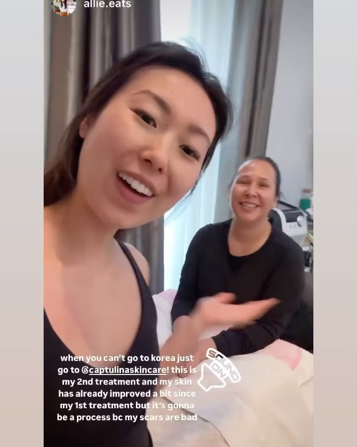 Hi everyone!! Follow @allie.eats skincare journey as we get her skin wedding ready for her big day! #professionalkoreanskincare