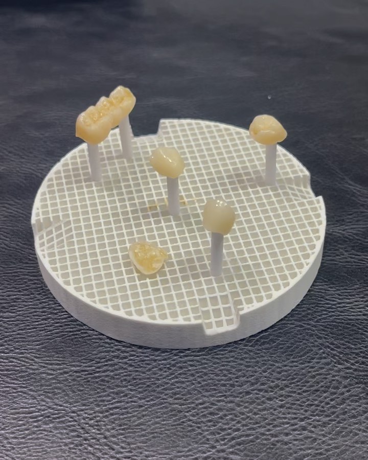 Me gusta mucho estas coronas 🔻
🔻
🔻
🔻
🔻
⭐️ Hoy día es una realidad! nuestra nueva tecnología para rehabilitación oral mediante flujo de trabajo digital: escaneo intraoral, diseño digital de restauración, y creación Robotizada, mediante fresado e impresión 3D.
🔻
YA DISPONIBLE PARA NUESTROS PACIENTES
🔻
🔻
🔻
#implandent #3dprinter #formlabs #dralinaquintero #rehabilitacionoral #odontologiaarmenia #rehabilitacionoralarmenia #implantesdentalesarmenia #odontologia3d #odontologiaestética #armeniaquindio #esteticadental #shining3d #OdontologiaCADCAM #odontologíadealtacomplejidad