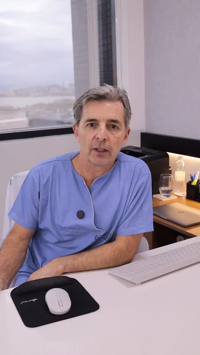 Dando sequência ao caso clínico que mostramos anteriormente, hoje explicamos a causa das varizes tronculares desse paciente.
Mesmo sem dor, inchaço ou queixa estética, o exame de ecodoppler mostrou um refluxo da veia safena magna desde a junção safeno femoral. Isso significa que o sangue não está “entupido”, como muitos imaginam. Ele até sobe em direção ao coração, mas também reflui para baixo por falha das válvulas da veia, aumentando a pressão nas veias colaterais e levando ao surgimento das varizes.
Na maioria dos casos, como nesse paciente, falamos de varizes primárias, relacionadas a uma doença da própria parede da veia. Situações secundárias, como após trombose, são menos comuns.
Com esse mapeamento completo, a indicação é de tratamento cirúrgico minimamente invasivo com endolaser. A técnica consiste em acessar a veia safena por punção guiada por ultrassom, introduzir uma fibra e realizar a ablação da veia doente, eliminando o refluxo.
E uma dúvida muito comum: ao fechar a safena, como o sangue volta para o coração? Cerca de 90% do retorno venoso acontece pelas veias profundas, como a femoral e a poplítea. Quando elas estão normais, o sangue retorna sem dificuldade, mesmo após o tratamento da safena.
Cada caso precisa ser avaliado individualmente.