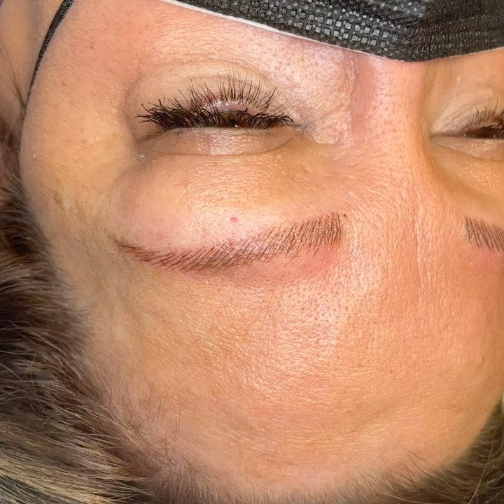 Swipe to see before ๐