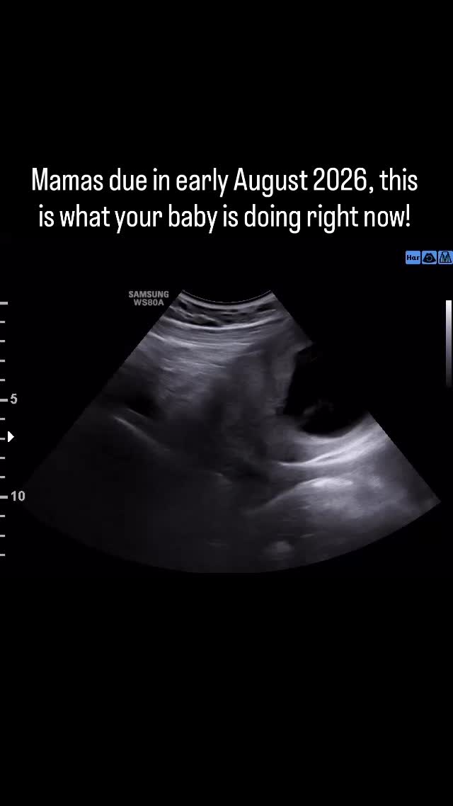 Wiggling, swallowing, and GROWING 😍🤰
#pregnant #pregnancy #ultrasound #baby #firsttrimester