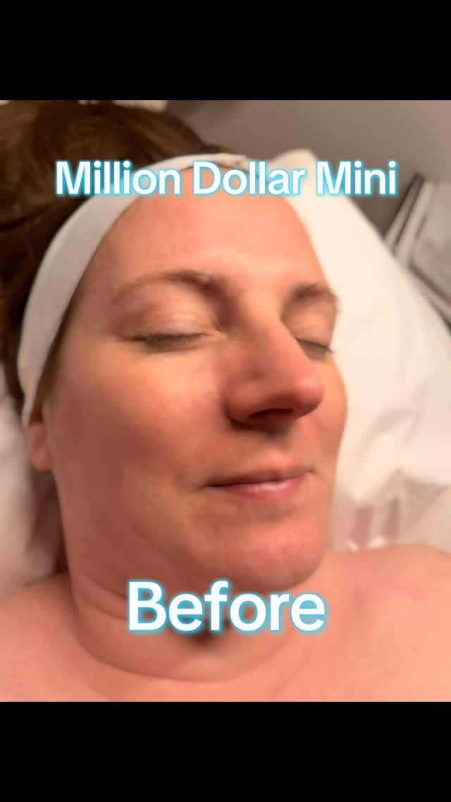 Fresh from the treatment and already looking beautifully refreshed. This facial works deep within the skin to boost radiance, smoothness, and that healthy, confident glow in the days ahead.
Ready for a little self‑care moment?
Book your Million Dollar Mini Facial on Fresha:
https://www.fresha.com/book-now/perfect-piercings-and-beauty-bbo0cko8/services?lid=914988&eid=3298793&share&pId=861248
Or DM me to enquire/book
#skincare #facial #selfcare #fyp #cambridgeshire