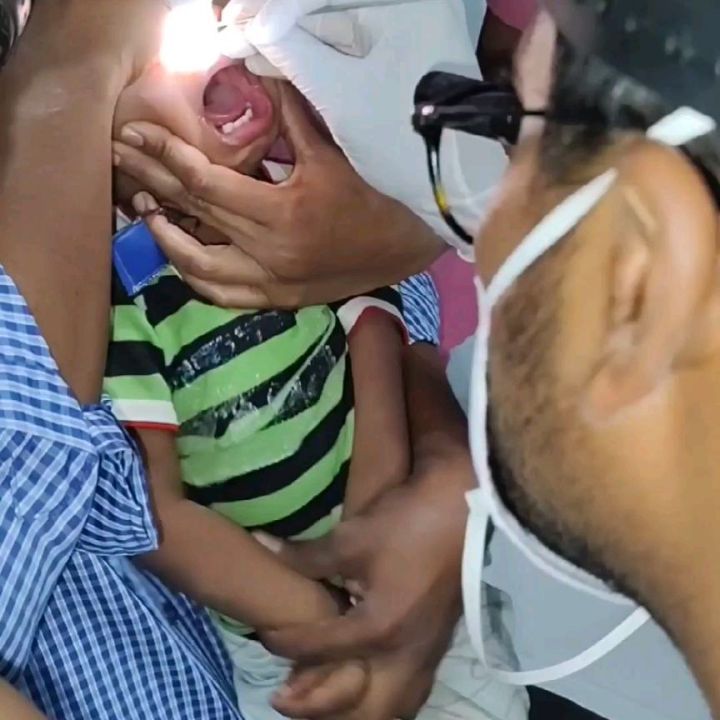 My kid put something in the nose 👃!!
Don't panic
We are here to help