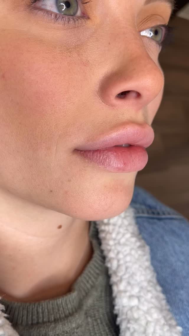 Lip Blushing is the perfect solution for a permanent lip stain.
What it is:
• A form of permanent makeup, also know as a lipstick tattoo that adds color and definition to natural lips.
• Improves symmetry, corrects blurred edges, and creates an illusion of fullness without fillers.
Book an appointment or consultation today!
BEAT & BLADE
(832) 377-5677
info@beatandblade.com
www.beatandblade.com
“Enhancing Lives One Image At A Time” ™️
#liptattoo #lipblush #pmu #pmulips #blackhistorymonth