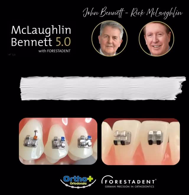 Le 10 aree chiavi dove MB5.0 fa davvero la differenza💪 #ortodonzia #bracket #johnbennett #mclaughlin