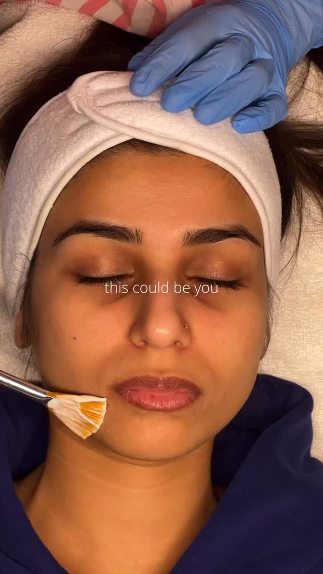 Healthy skin isn’t magic — it’s consistency
Small steps. Real results.
#skincarelove #skinbarrier #healthyskin #surrey #glowingskin skinroutine estheticianlife skinexpert