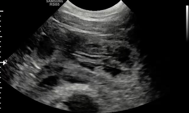 Een spannende dag met de 30 dagen echo! Van buiten is Indy de rust zelve, maar van binnen zijn de puppy's aan het groeien. Lees meer op de nieuwe blog (link in bio). #kooiker #kooikersofinstagram #kooikerhondje