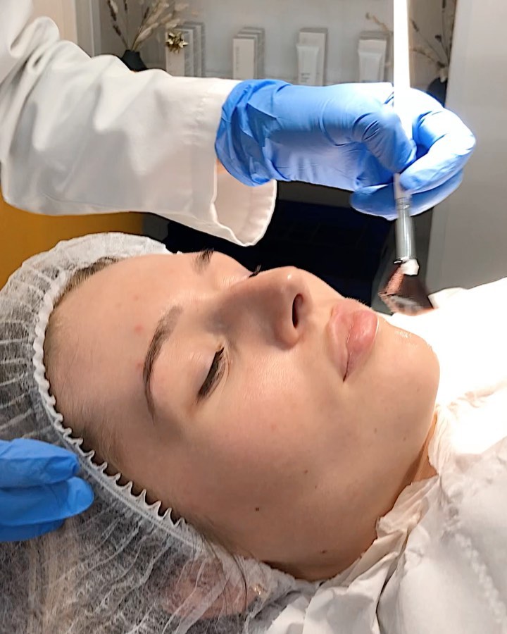 SKIN PEEL ✨
Skin peels are highly recommended to freshen up the skin and help treat acne, oily skin, pigmentation, fine lines and wrinkles, photo damage and skin ageing.
At @drmendelovici we use @dermaceutic Milk Peel which contains 50% glycolic acid, salicylic and lactic acids - the perfect combination for skin lightening, oily skin regulation, spot treatment and fine wrinkle reduction!
For optimal results we recommend to repeat treatment every 2 to 4 weeks depending on your skin sensitivity.
Our secret tip for a healthy glowing skin? Combine a skin peel with our MesoGlow treatment 😍
Call 07901206846 or email contact@drmendelovici.com to book you treatment 🔝