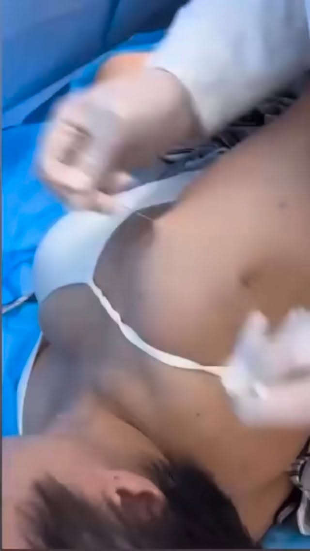 If a needle could physically break apart adhesions in tissue, we’d call it surgery — not acupuncture.
⭕️
Let’s be clear:
🪡 Passing a big needle through tissue doesn’t melt scar
🪡 It doesn’t reorganize collagen
🪡 It doesn’t “release” fascia
What it does something this aggressive do?
➡️ Create more tissue damage
➡️ Trigger more inflammation
➡️ And guess what the body responds with?
👉 More scar.
⭕️
What does reorganize collagen? Signaling to the fibroblast, and those little beings only speak in the language of load 🏋🏽♀️💪🏽
Less theatrics. More movement.
Less tissue trauma. More tissue capacity.
#whatthecup #dryneedling #acupuncture #whatthecupwednesday #adhesions