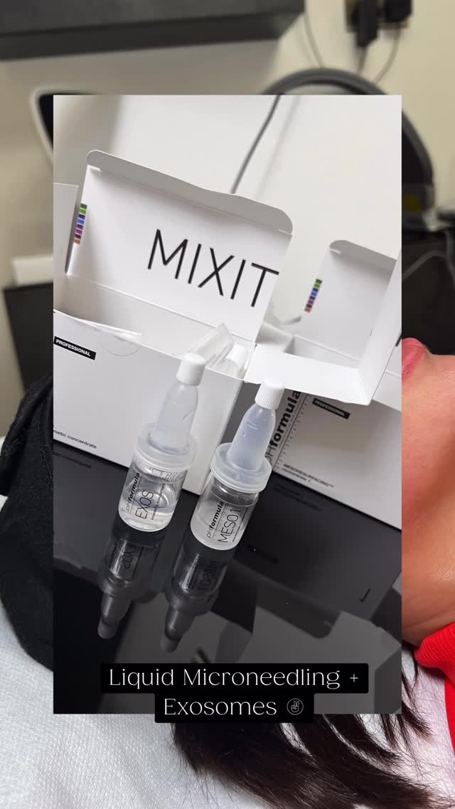 ✨ Next-level skin regeneration in action
pHformula’s newest M.E.S.O. X Liquid Microneedling with Exosomes — a cutting-edge treatment designed to repair, rejuvenate, and restore skin from within.
💎 Why we love M.E.S.O. X with Exosomes:
• Boosts cell communication to support natural skin regeneration
• Improves skin texture, tone, and radiance
• Helps strengthen the skin barrier
• Supports collagen and elastin production
• Ideal for dull, tired, ageing, or stressed skin
Exosomes act as powerful messengers, telling your skin cells to behave younger, healthier, and more efficiently — resulting in visibly fresher, smoother, and more luminous skin ✨
📍Want to experience this advanced skin treatment yourself?
Book your consultation at www.doctorbianca.co.uk
#DoctorBianca #AestheticMedicine #LiquidMicroneedling #ExosomeTherapy #pHformula SkinRegeneration GlowingSkin AdvancedSkincare