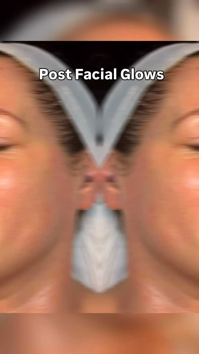 A little mix of post‑facial magic — different skin types, different goals, all looking refreshed and cared for.
Start your journey today, take the time to properly relax whilst looking after your skin 💗
Book in with Flawless Skin by Kathryn - Fresha link below. Or DM me directly.
https://www.fresha.com/book-now/perfect-piercings-and-beauty-bbo0cko8/services?lid=914988&eid=3298793&share&pId=861248
#skincare #selfcare #fyp #massage #facial