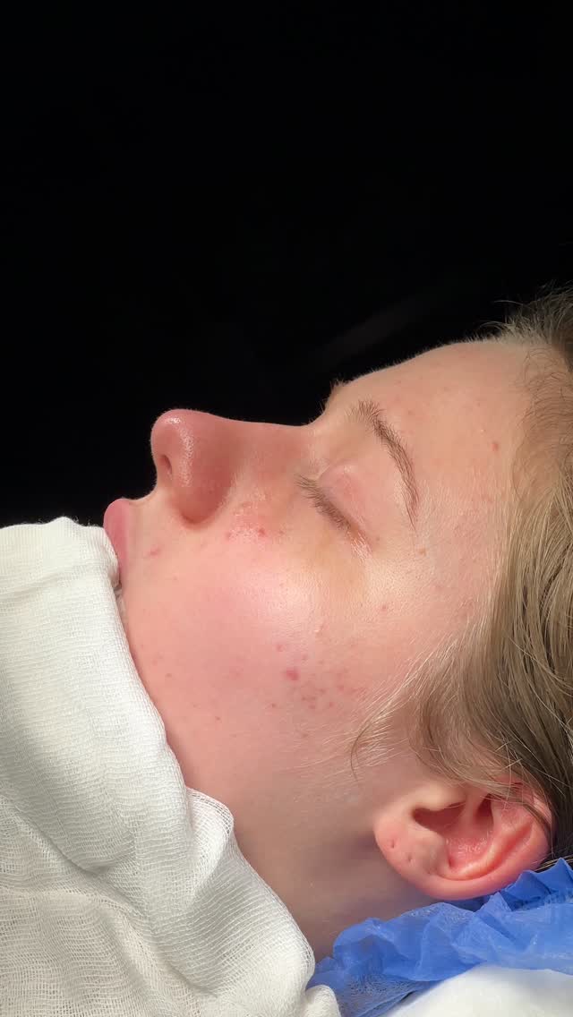 Deprojection💪
⭐️⭐️