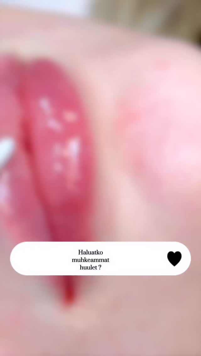 Huulten muotoilu on suosittu hoito 💋
