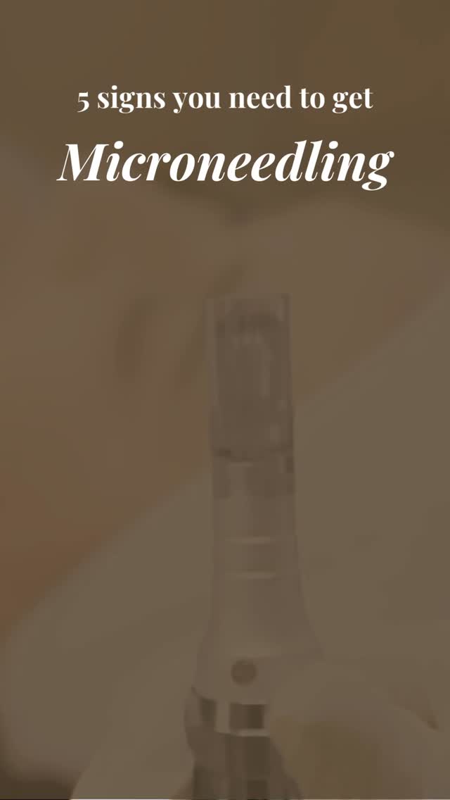 Let’s be real: you’re buying the expensive serums, but the glow just isn’t there.
When your skin hits a plateau, even the best Product can’t penetrate deep enough to make a difference.
Your skin isn’t “bad” it’s just locked.
Microneedling is the key. By creating invisible micro-channels, we force your skin to restart its own collagen factory and finally allow your skincare products to reach the layers where they actually work.
Stop wasting your favorite Product on the surface. It’s time for a reset.
🌿 Ready to see the change?
Tap the link in bio to book for a Free 15-minute Beauty Coach Consultation. Let’s look at your Skin Profile and get your glow back on track.
💘 VALENTINE’S SPECIAL: Take 15% OFF your Microneedling session! Use code VALENTINE15 when you book before Feb 15th.
#LightAngelAmsterdam #Microneedling #AmsterdamSkin #SkinPlateau #ClassPassAmsterdam LeSublime