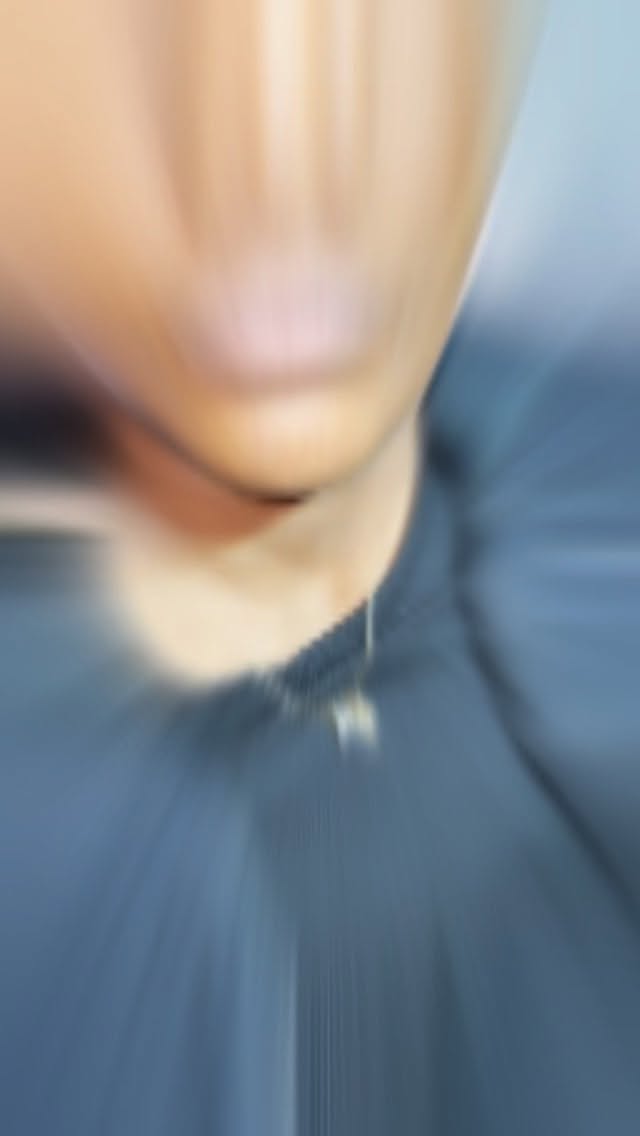 Can we say perfection !!! 😍 1mL injected using micro needle 💉 booking link in bio dm, for questions. 🫶🏽 #lipfiller #hyaluronpen #lipinjections #facialbalancing #tampalips