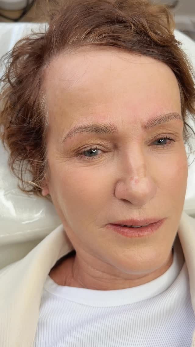 💁♀️Another day, Another Blush Hairstroke Brows for My client from Auckland ❤️❤️
#hairstrokebrows #browsonpoint #microblading #strokebrows #wellington