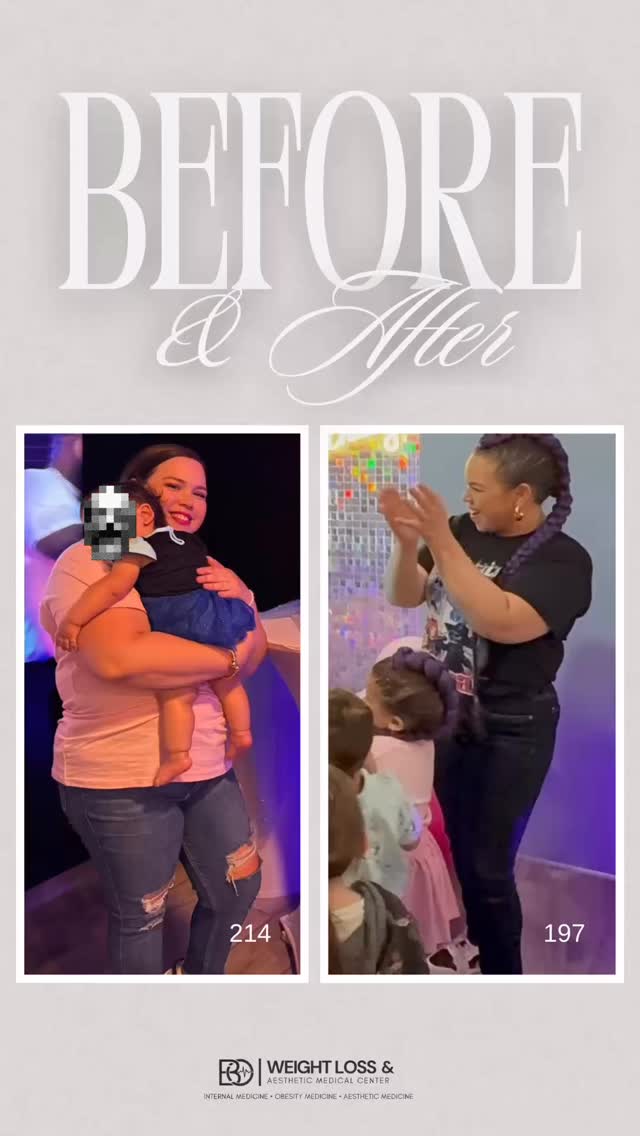 At BOmedicalcenter, our medical weight management program in Jacksonville is led by doctors specialized in obesity medicine and metabolic health. We focus on identifying the root causes of weight gain and creating personalized, medically supervised plans designed for safe, sustainable, and long-term results.
Our program goes beyond temporary solutions. We combine medical expertise, metabolic evaluation, lifestyle guidance, and ongoing support to help you improve your health, increase energy, and regain confidence. Every patient receives individualized care based on their body, metabolism, and goals.
Whether you are struggling with weight loss resistance, metabolic imbalance, or simply need professional guidance, our Jacksonville obesity specialists are here to help you achieve real change with a science-based approach.
This is not about quick fixes. This is about transformation, guidance, and lasting health.
BOmedicalcenter — Inspire Change
📞 Call us: 904-467-4431
💬 Write us your number to contact you!
🗣️ (904)___-______
📍 6100 Greenland Rd suite 301
Jacksonville,Fl 32258
Follow our medical staff:
👩🏾⚕️ @the_metabolic_md
👨🏻⚕️ @drjosebird
Hablamos español
🌐 www.bomedicalcenter.com
Facebook @b.o.medicalcenter
Instagram @b.o.medicalcenter