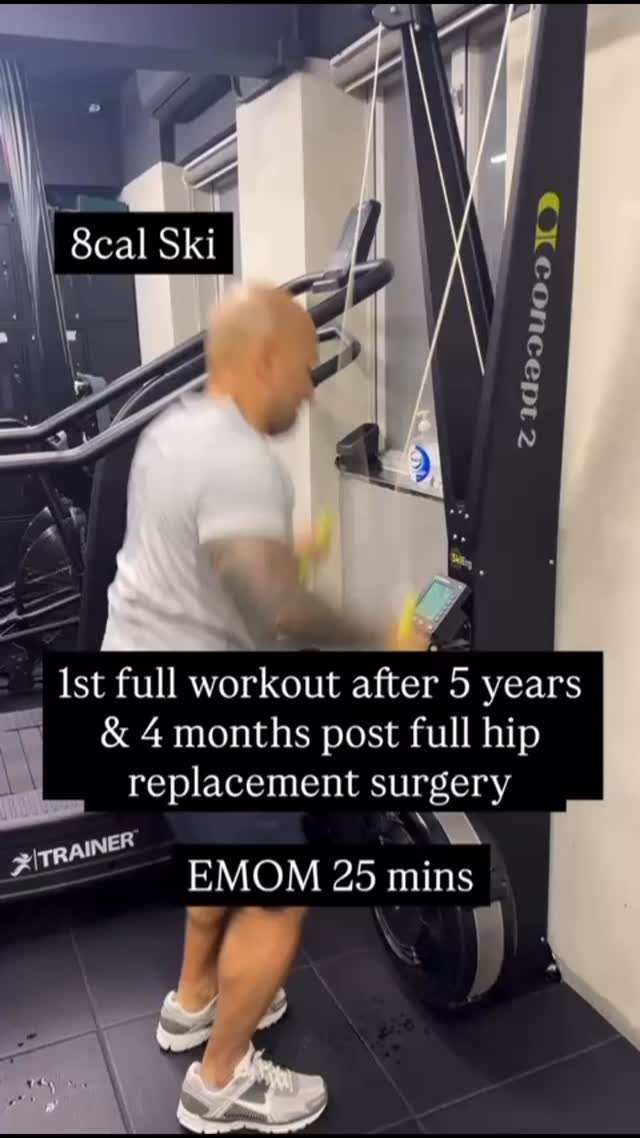 First full workout after 5 years & 4 months post full hip replacement surgery
EMOM 25 mins
8 cals ski erg
3 wall walks
8 clean & press
8 burpee pull ups
1 min rest
#guardianfitnesshk #privategym#gymcentralhongkong#centralpersonaltraining