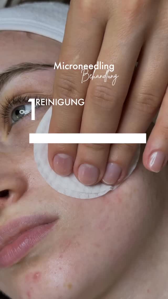 Strahlende Haut beginnt hier ✨
So läuft eine Mikroneedling-Behandlung bei uns: Reinigung – Behandlung – Maske – Glow! 💖
Hast du Fragen oder willst du deinen Termin sichern? Schreib uns direkt!
#Mikroneedling #GlowUp #Hautpflege #Kosmetikstudio #nurnberg
