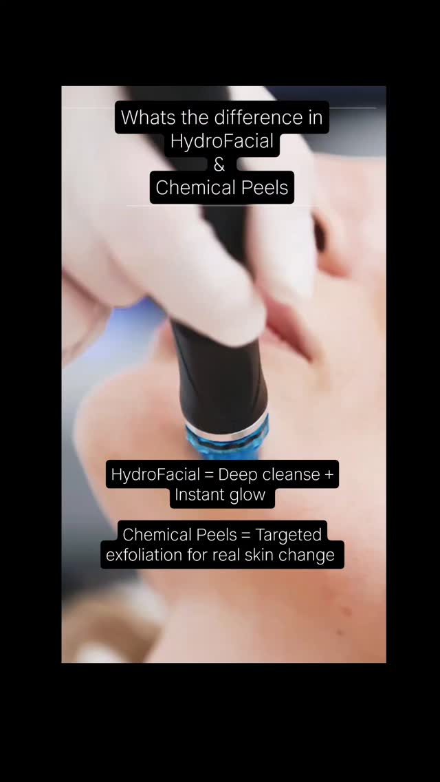 HydroFacial vs Chemical Peels – what’s the difference?
HydroFacial
A gentle, multi-step treatment that deeply cleanses, exfoliates, extracts and hydrates the skin. Perfect for instant glow, dehydration, congestion and dull skin with no downtime.
Chemical Peels
Use active acids to exfoliate deeper layers of the skin, targeting concerns like pigmentation, acne, fine lines and uneven texture. Results build over time and some downtime may be required.
Different treatments, different purposes — your skin goals decide which is best.
Book a free consultation today and we can discuss your skin concerns and tailor make a treatment plan based on your skin.
#essexfacial #essexfacialist #essexchemicalpeels##essexhydrafacial #basildonskinclinic