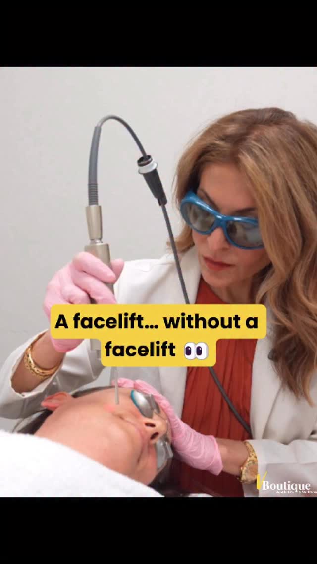 Watch to the end of this short reel to witness before-and-after results of our Fotona 4D laser treatments 👀✨
For the past 20 years, I’ve treated patients with countless laser platforms and watched aesthetic technology evolve in incredible ways. And after working with 15+ laser devices in our practice, one system truly stands out: Fotona 4D 🔬💫
Why? Because this is the only device that treats all 4 layers of skin in a single session with multiple laser wavelengths, including an intra-oral step 👄 where we deliver laser energy from inside the mouth to gently heat tissue, stimulate collagen, and lift the skin in a way no external treatment alone can achieve. It’s science-driven tightening and remodeling at a deeper level 🔥
Fotona 4D uses four customizable steps:
1️⃣ SmoothLiftin™️ – intra-oral collagen stimulation
2️⃣ FRAC3®️ – targeted tightening & wrinkle reduction
3️⃣ PIANO®️ – deep bulk heating for firming
4️⃣ SupErficial™️ – skin polishing & glow ✨
Every step is adjustable and tailored to each patient’s anatomy and goals 🎯
In our practice, we’ve taken this even further. I’ve developed advanced 7-step protocols for patients who need more significant lifting, tightening, regeneration, and wrinkle reduction — and I’ve lectured on this approach at the Fotona Super Symposium 🎤📚
The result? A comprehensive, science-based treatment that delivers beautiful, natural, transformative results 💖
Treatment is surprisingly comfortable (just topical numbing) 😌 and downtime is fully customizable — from none at all to a few days of gentle peeling 🌤️
📞Call or text us at 561-357-2020 for more info!
#Fotona4D #LaserRejuvenation #SkinTightening #LaserExpert #nonsurgicallift
